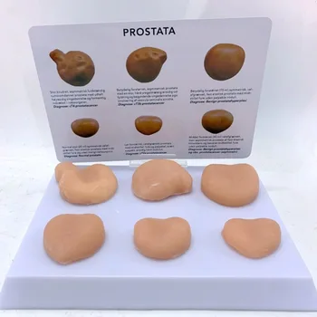 Vyrų Anatomiją Prostatos Patologijos Modelis Lytinių Organų Minkštas Silikagelio Modelis
